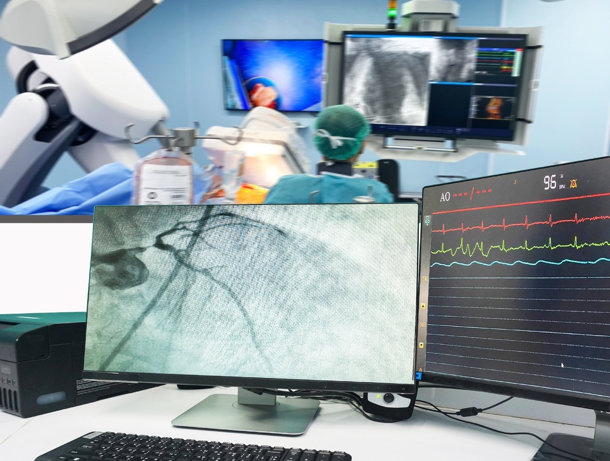 Especialistas revisando un angiograma coronario en el monitor de una sala de hemodinamia moderna